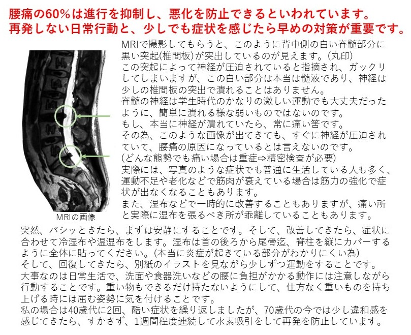 腰痛の60％は大丈夫